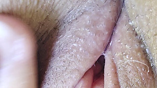 A Swollen Clitoris Looks Even Fleshier up Close