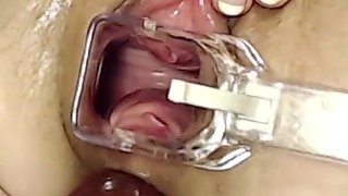 Extreme Pussy Play with Speculum and Peehole Fuck