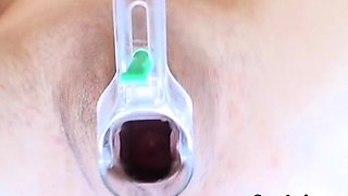 Speculum teen enjoys objects insertion