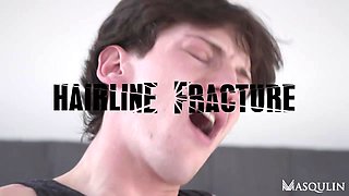 Hairline Fracture - Bro Network