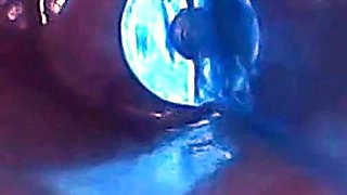 Endoscope POV: Test Tube Cock Urethral Insertion