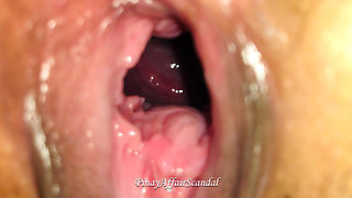 18 Year Old Teen Got Cute Pussy Moles Close up Open Wide