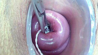 Lesbian piss inside the Uterus of other with tube in PeeHole
