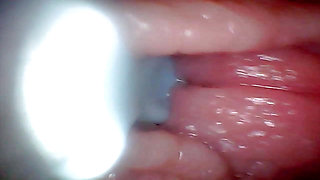 First Time: an Endoscope Reveals the G-spot up Close - Without Mounting!