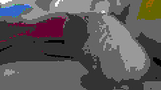 The Glans Appears Crowning Inside the Phimosis.