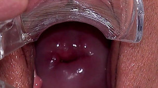 Big Clit Pussy Examined with Speculum