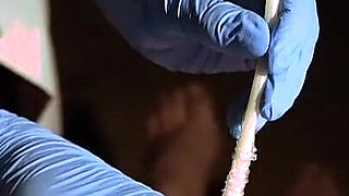 POV Patient. Sounding and Placing a Catheter