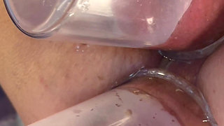 Extreme Close up Double Vacuum Pumping Ass and Pussy