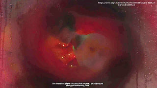 B019 Long Video with Plot Man Shrunk and Stuffed Into Anus Rectum in Vivo View POV